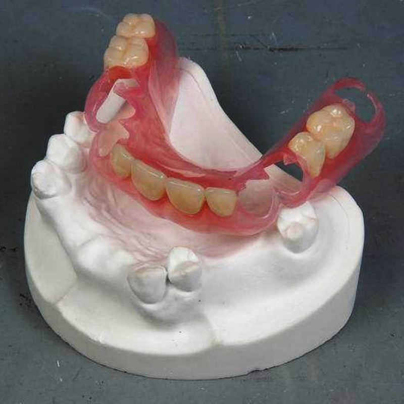 Valplast denture