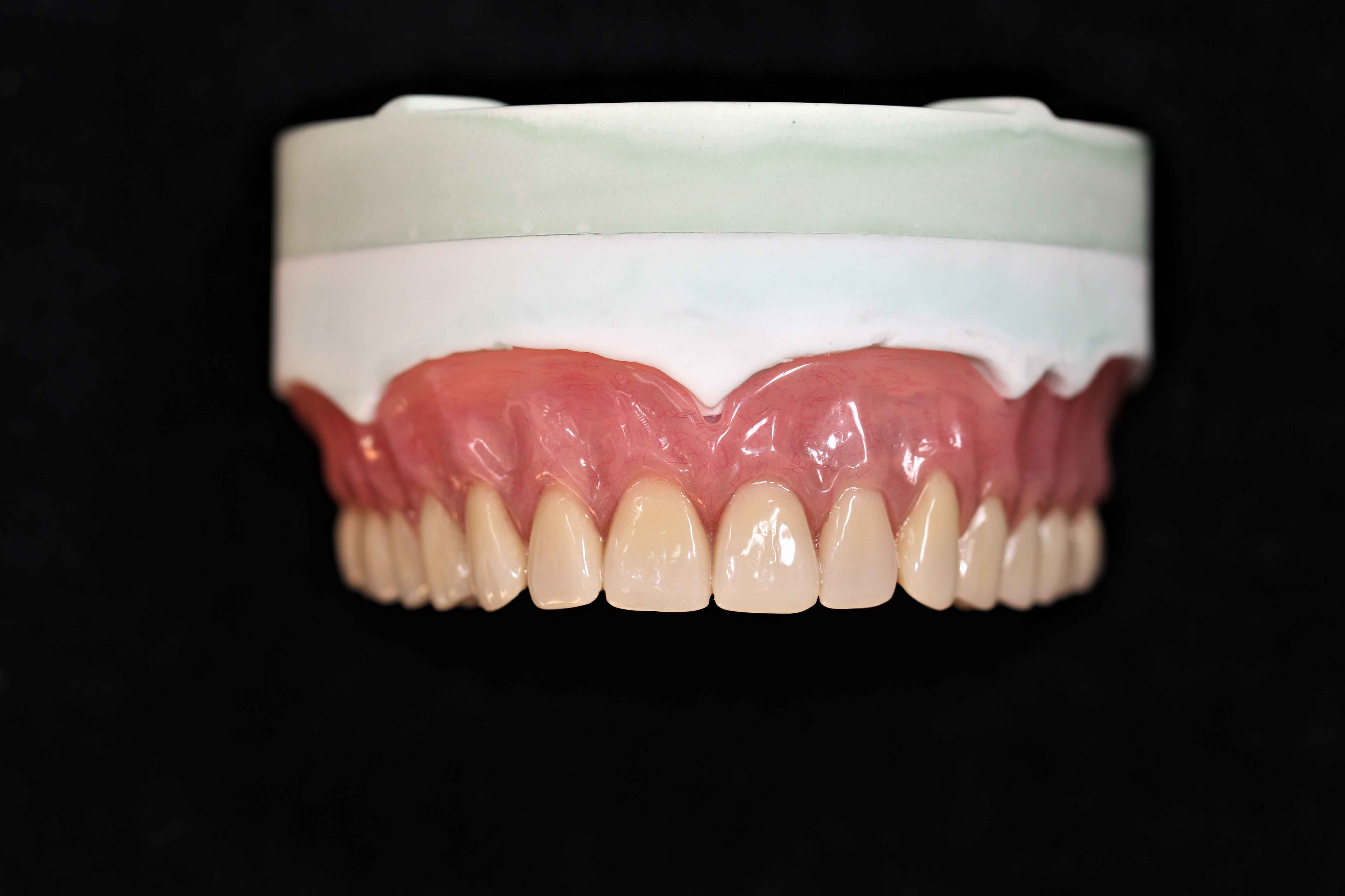 Sina dentalis lab determinatio verticalis distantiae plenae denturae