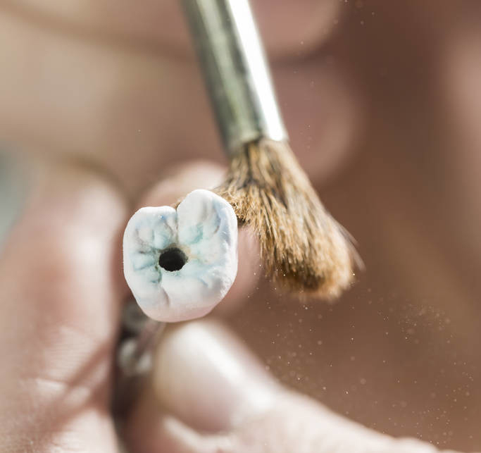 Quam diu est spatium dentalis implantatorum?