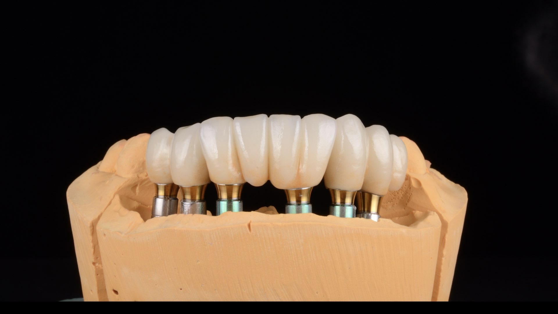 Quomodo curam dentalis implantatorum?