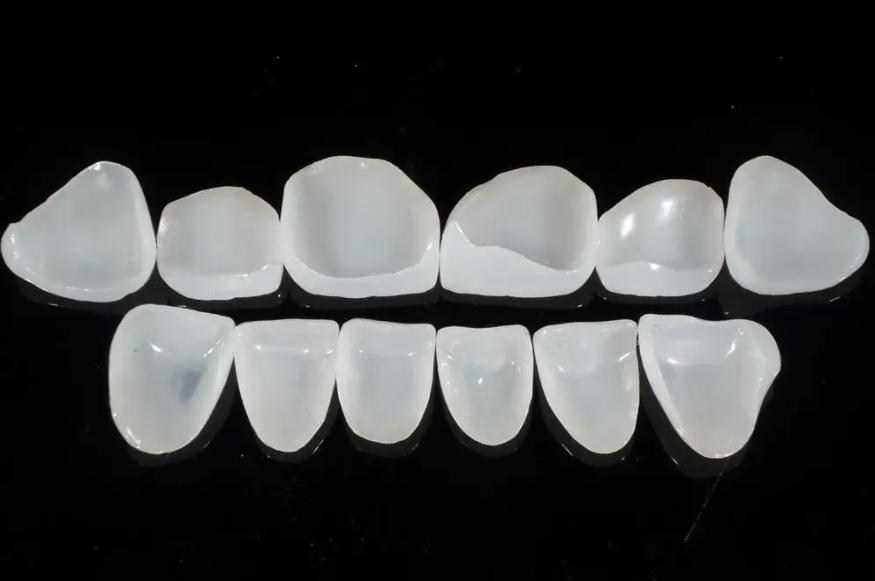 Quae sunt commoda crusta dentalis?