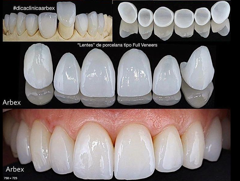 Quos cibos post surgery dentalem non edam?