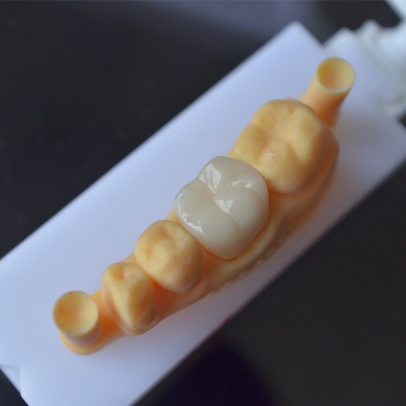 Quam circa 3D dentes excudendi? Lorem perfectum est?