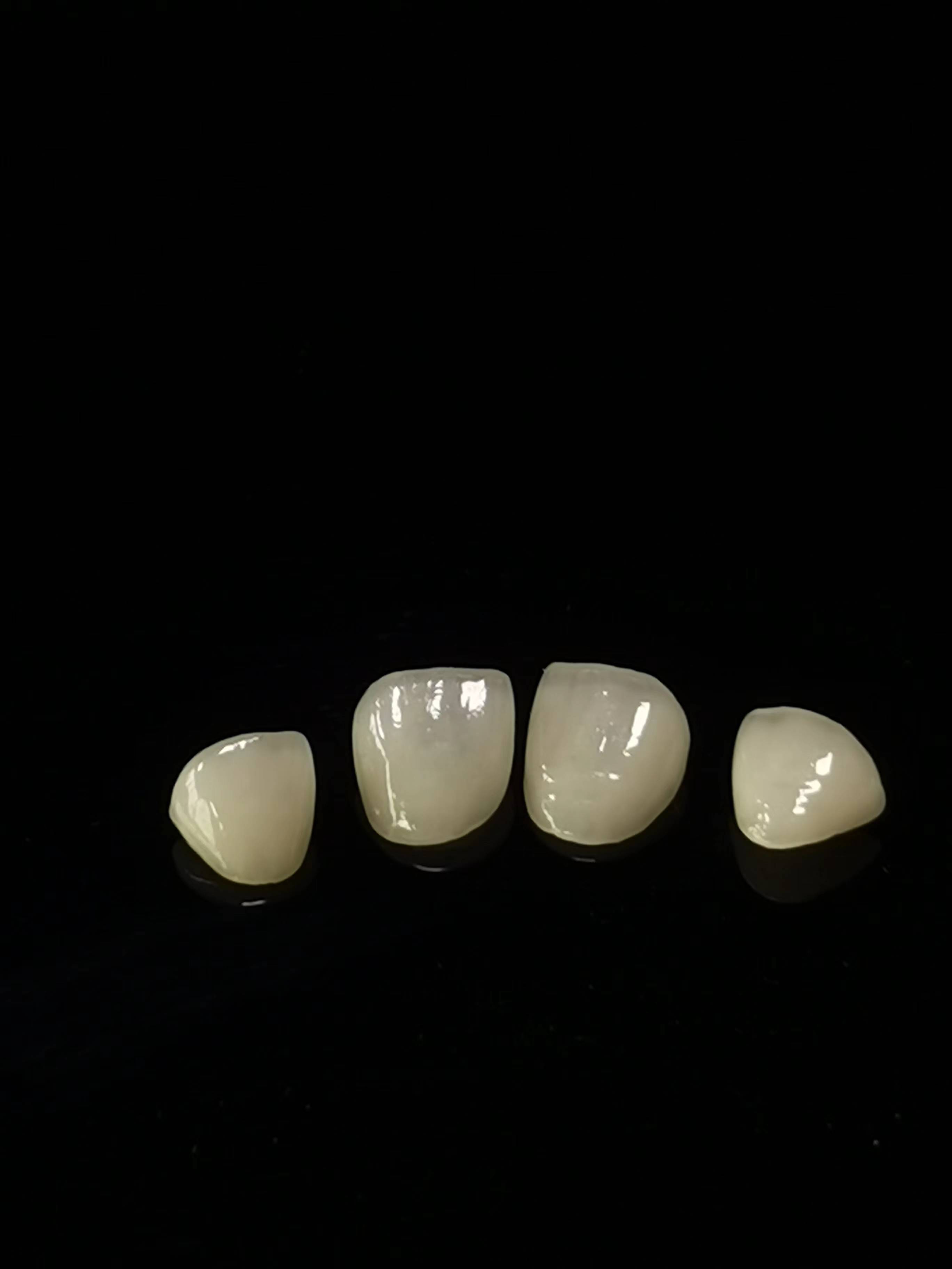 E.max Dental lab Opus