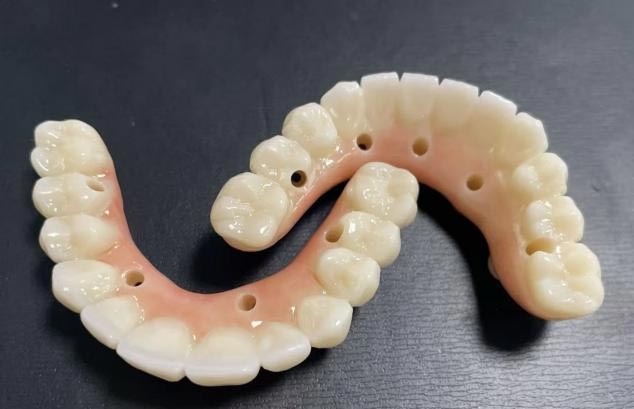 Quod melius: amovibilibus denturis vel fixis denturis?