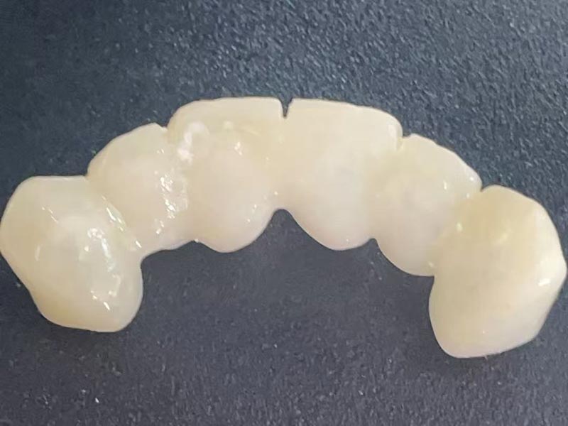 Quid est corona temporalis? Cur unum eges?