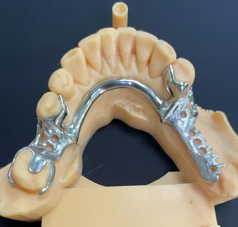 Commoda Cobalt-chromium Framework (Co Cr Framework)