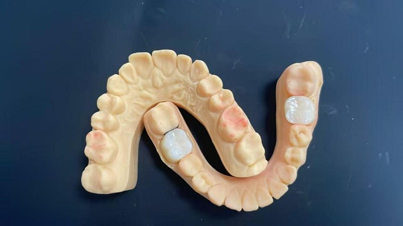 Quid est margo humeri?