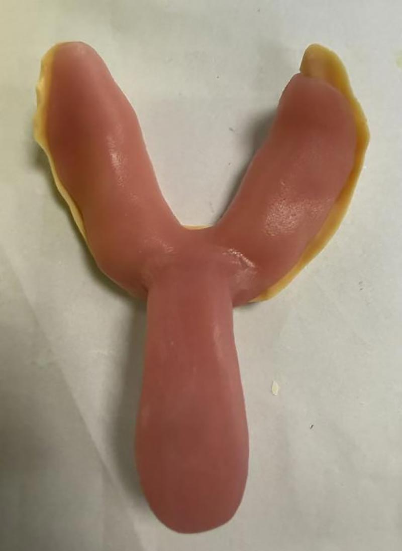 Quae nesciebatis de Custom dentalis Trays