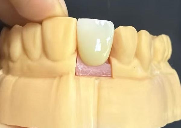 Lacunae inter dentes figi possunt, rectae dentes sunt amabilissimi!