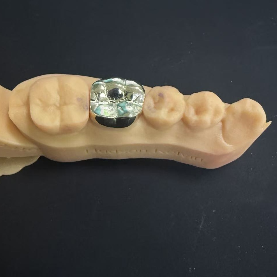 Coronae aureae: Pretiosa metallo electio ad vitam aeternam Vesalius restitutio