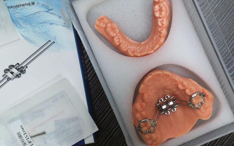 Intellige MSE Laxamentum Osseum cum WM Dental Lab