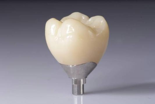 Optimize eventus tui cum Zirconia restitutionis (Corona, Pontium, implantatorum)