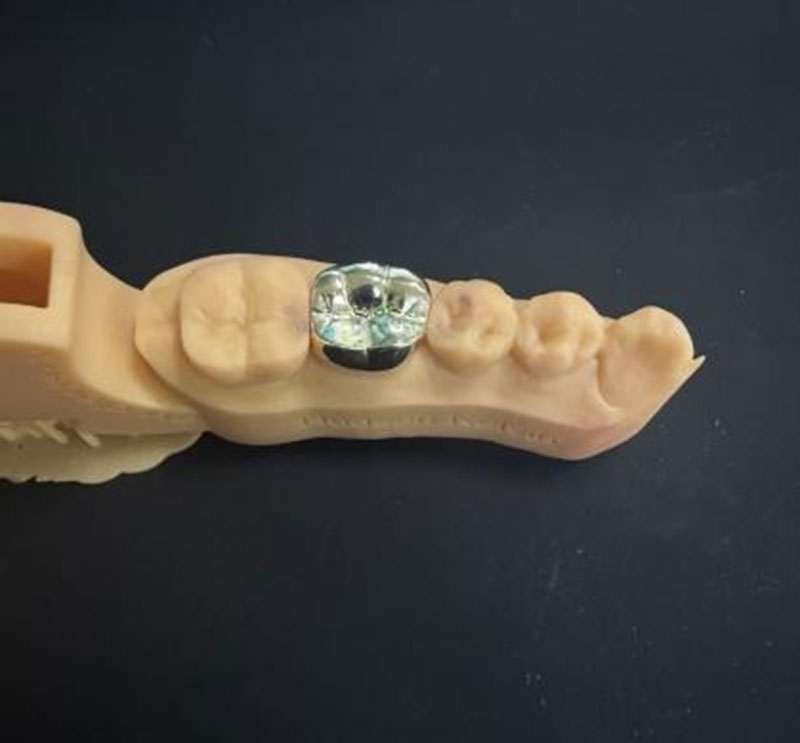 Aurum Dentes VS NPG Dentes