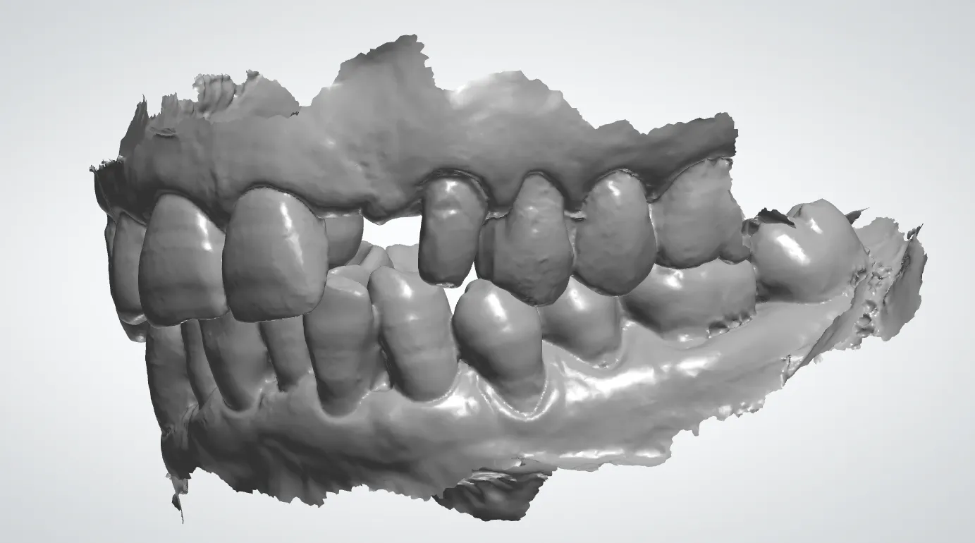 Mors tua restituet: solutiones ducit ad Absentis dentium