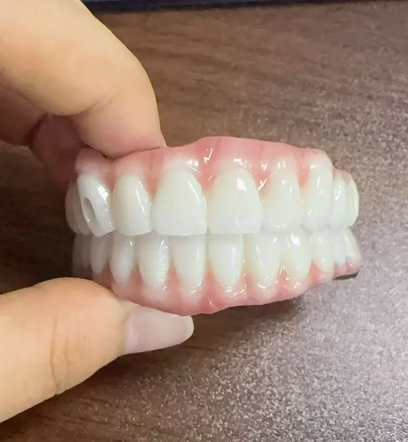 Periculis Malocclusion