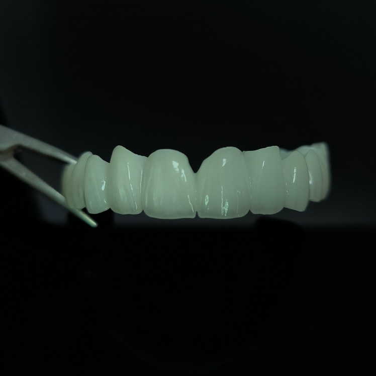 Princeps Translucens Zirconia Ponte Stratum Zirconia Sinis Dental lab opere