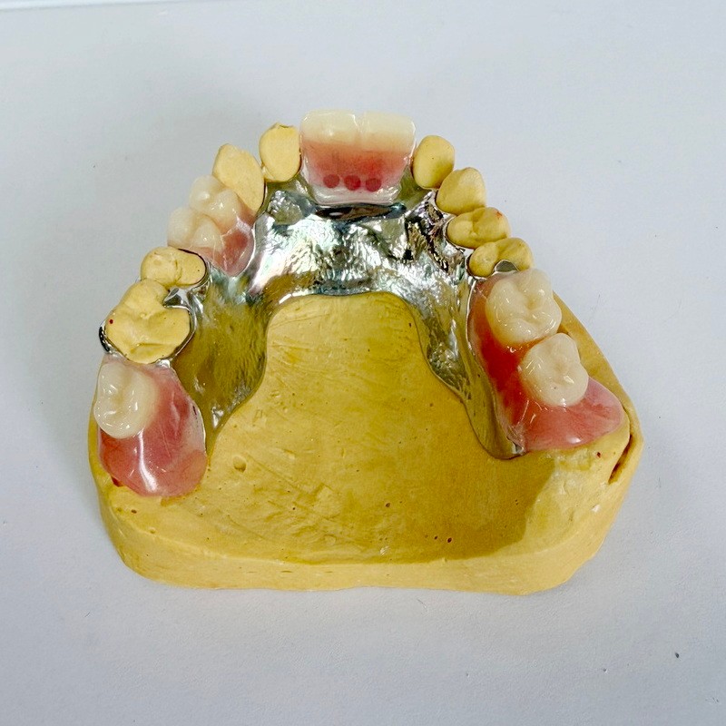 Removibilibus restitutio partialis Framework